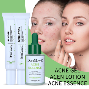 Acne Creme Loção Essência Set <span class=keywords><strong>Oil</strong></span> Controlan Poro Apertar Cicatriz Lightemins Ceddce cravos Soro Anti Acne Produtos - Product Image 2