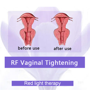 Machine de resserrement vaginal Nébuliseur de lavage gynécologique à l'ozone Traitement à l'oxygène pour les salons Combinaison de gel de serrage vaginal - Product Image 2