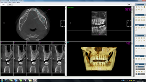 最佳结果牙科器械口腔单元数字CBCT 3D OPG x光CT扫描仪MSLDX20带头影测量功能 - Product Image 6