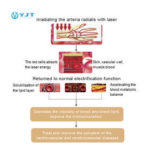 OEM tùy biến tăng huyết áp <span class=keywords><strong>cholesterol</strong></span> lllt trị liệu laser xem 650nm cho đột quỵ phòng ngừa lâm sàng nghiên cứu trị liệu đồng hồ - Product Image 2