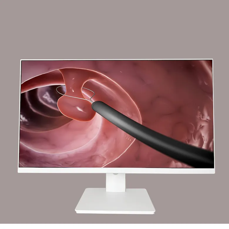 Monitor cirúrgico médico 4k monitor4k Color monitora equipamentos 21.5 ''27'' completo hd endoscópico sistema de câmera LCD monitor