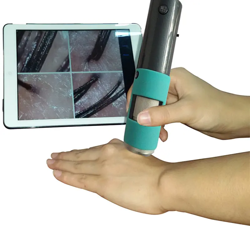 Detector de pele sem fio portátil m30f 300x 600x, mini microscópio de cabelos e couro cabeludo, com wi-fi