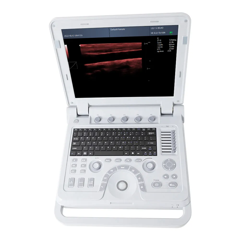CONTEC CMS600P2PLUS-VET veteriner ultrason b vet renkli doppler ultrason makinesi taşınabilir doppler ultrason