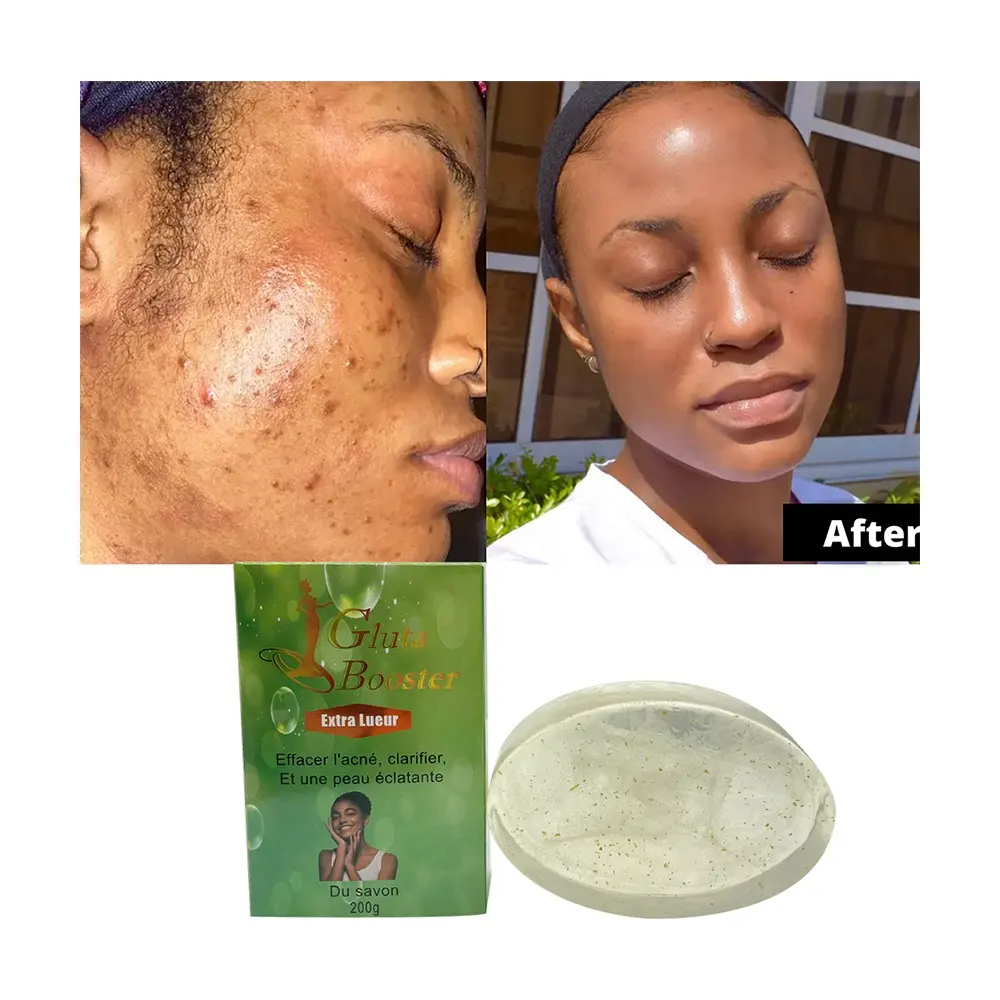 Etiqueta privado de cuidados com a pele, sabão transparente para limpeza da pele, espinhas e acne, removedor de manchas escuras para africano