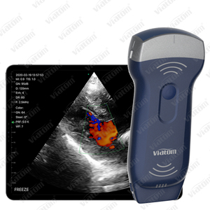 MSK <span class=keywords><strong>ultrasound</strong></span> adalah integral dari penilaian neuromusculette komprehensif untuk memandu rencana perawatan rehabilitasi - Product Image 4