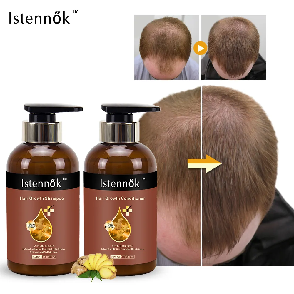 Isk Premium Biotine Dht Blocker Hydrolyzed Keratine Plantenextracten Zorg Gevoelige Hoofdhuid Haargroei Shampoo Conditioner