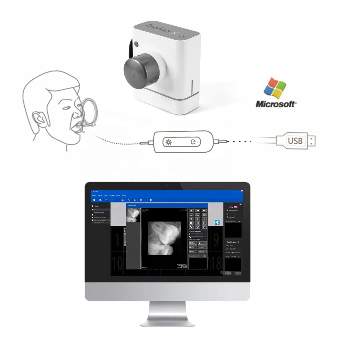 Sensor DE RAYOS X dentales de alta calidad, sensor intraoral RVG, tamaño adecuado para niños (un solo diente para adultos) y Mascotas