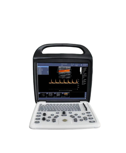 Échographie portable 4d pour centre d'imagerie diagnostique médicale utilisant l'échographie couleur pour la gynécologie - Product Image 6