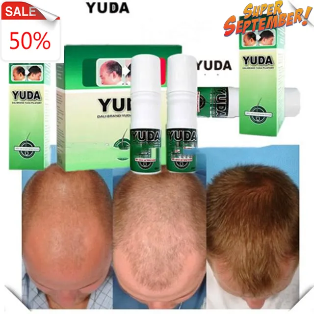 Amostra livre de tratamento de cabeça careca yida, tratamento de crescimento do cabelo novo, tratamentos anti perda de cabelo, kit de spray