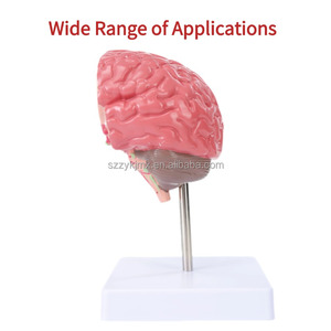 Scienza medica organo umano patologico del cervello modello di anatomia del cervello che mostra ictus emorragia cerebrale aneurisma strutture cerebrali - Product Image 6