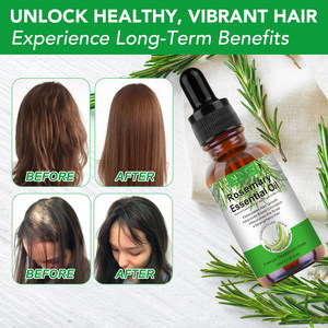 ALIVER 30ml organik saf doğal biberiye özü yağı siyah kadın saç tamir saç büyüme için kafa derisi besleyici biberiye yağı