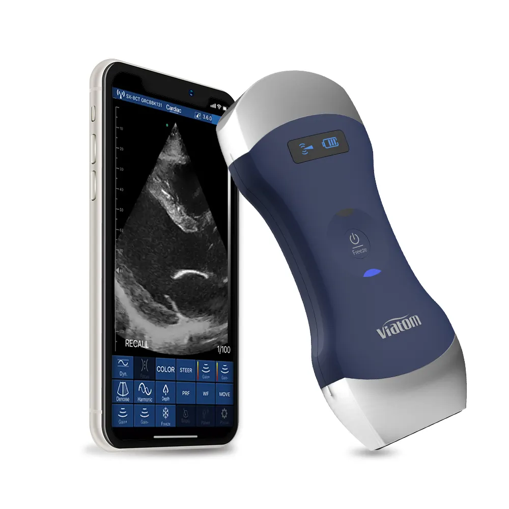 Viatom Handheld Ultrasound Doppler 18 Frames ad alta velocità Clear Image testa lineare/convessa ultrasuoni Wireless portatili per uso domestico