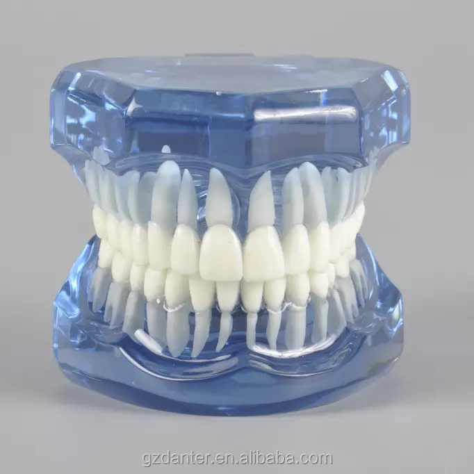 Modelo de ortodoncia Dental, tipodón con mandíbula transparente sin tirantes, dientes de ortodoncia, modelo de estudio sin tirantes azul