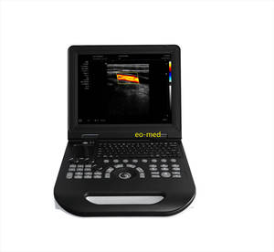 Ứng dụng lâm sàng siêu âm DOPPLER màu máy siêu âm hiệu suất cao máy siêu âm cu30 - Product Image 1