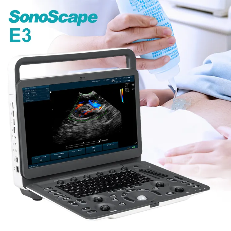 Sonosape-máquina de ultrasonido portátil, máquina de ultrasonido E3, Doppler, Digital, cardíaca