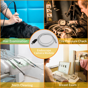 Oem Aangepaste Mini Endoscoop <span class=keywords><strong>Camera</strong></span> <span class=keywords><strong>Module</strong></span> Vga Sensor 85 Graden Led Full Hd Flexibele Endoscopie H.265/H.264 Video Compressie - Product Image 6