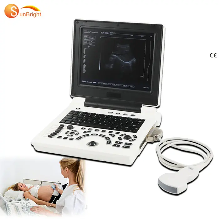 Mesin Ultrasound BW Portabel medis, sistem diagnostik rumah sakit ultra terang Laptop