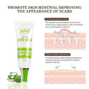 Herbal Essence crème d'élimination des cicatrices d'acné visage Dack crème d'élimination des taches extrait de plantes végétaliennes crème contre l'acné pour la peau noire - Product Image 3