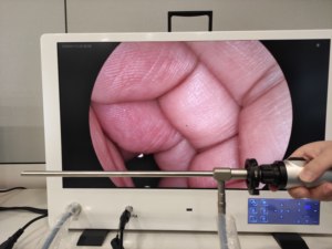 Sistema de câmera endoscópica All-in-One Full HD para cirurgia