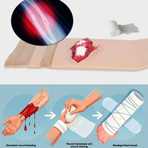 KyrenMed <strong>Open</strong> <strong>Fracture</strong> of <strong>Tibia</strong> Training Model Wearable Wound Simulator Traumatic Injuries <strong>Open</strong> <strong>Fracture</strong> of the Limb - Product Image 6