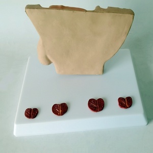 Human Male Abdominal Cavity Bladder Prostate Health Disease Comparison Medical Teaching Doctor-Patient <strong>Explanation</strong> Model - Product Image 5