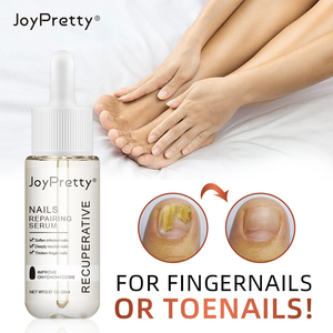 Wholesale Effective Nail Treatment <strong>Anti</strong> <strong>Fungal</strong> Nail Repair <strong>Solution</strong> Remove Onychomycosis Toe Nail Gel Repair Serum