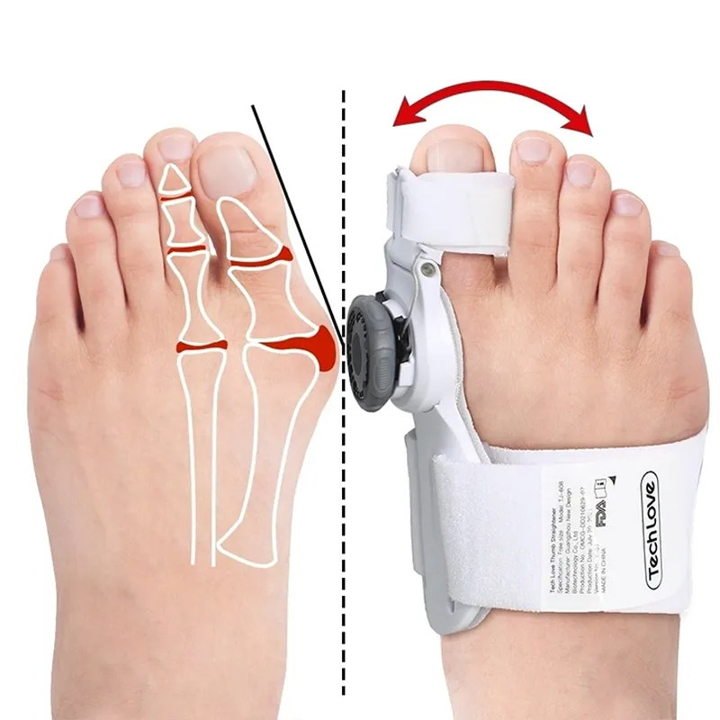 Separatore di stecca per alluce a piede fisso multidirezionale correttore ortopedico per alluce valgo regolabile per prodotti per la cura dei piedi