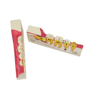 Răng Miệng dưới bên phải và tổn thương sâu răng ZM1049-11 mở rộng smt023 - Product Image 3