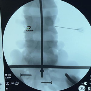 Transforaminal Endoscope Simulation <strong>Human</strong> <strong>Back</strong> Model TESSYS Model Lumbar Disc Herniation Training Model - Product Image 4
