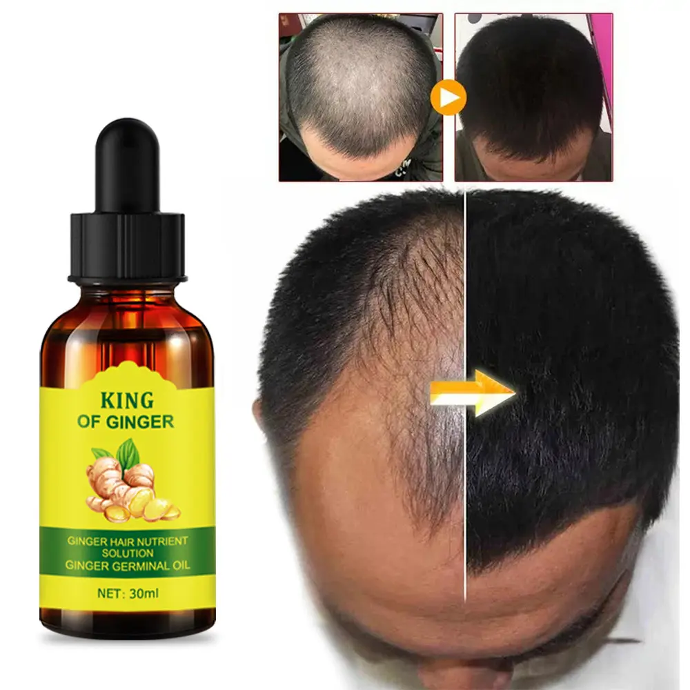 Bán Buôn Nhãn Hiệu Riêng 30Ml Gừng Dầu Tăng Trưởng Tóc Tinh Dầu Cho Rụng Tóc Điều Trị Mọc lại Huyết Thanh Batana Dầu Cho Tóc