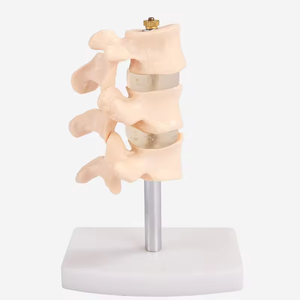 SCIEDU 2 Teile Osteoporose Läsion modell Wirbelsäulen-und Zervix dissektion gelenk modell Menschliche Anatomie Lendenwirbel modell - Product Image 4