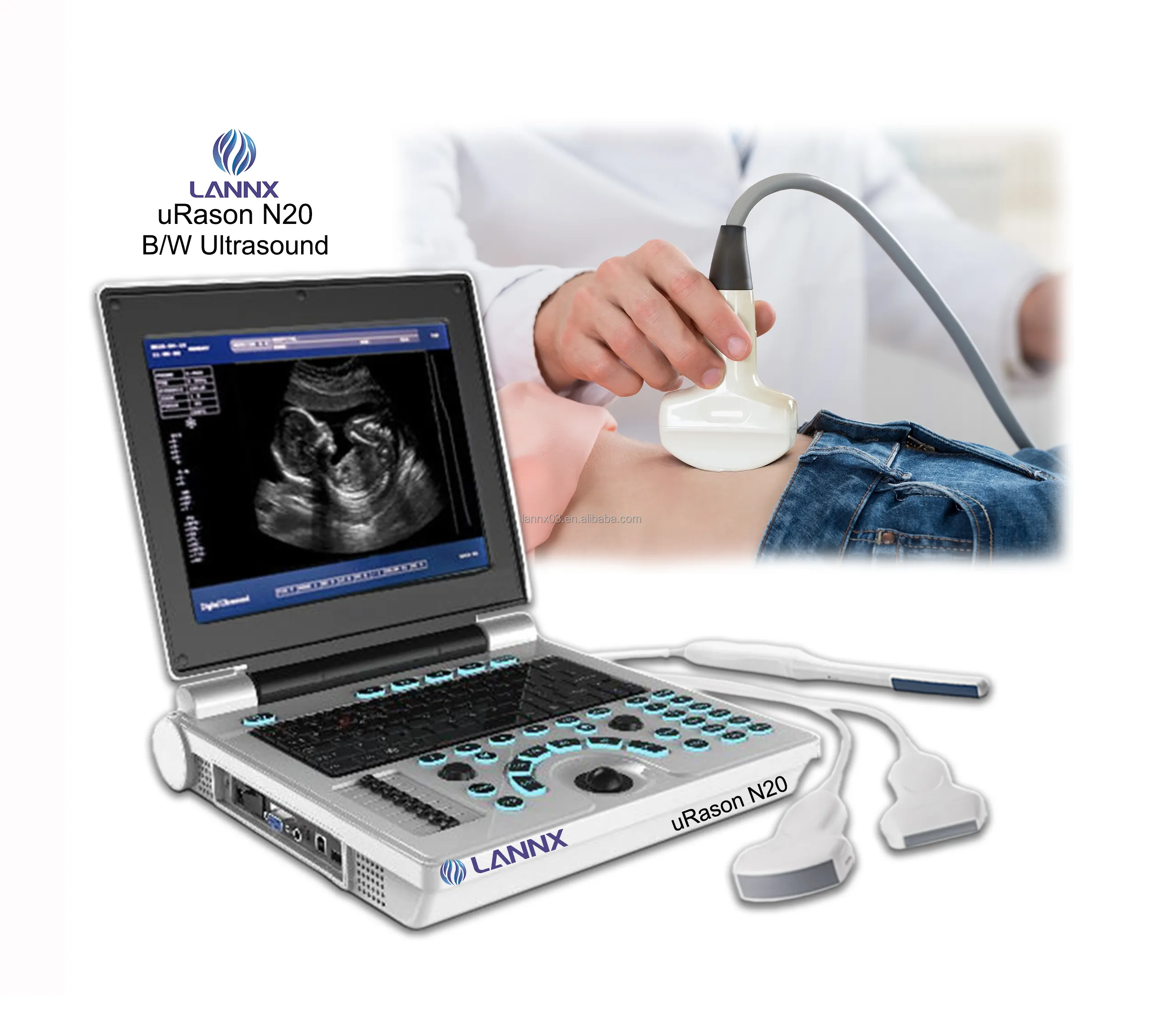 LANNX uRason N20 HD tıbbi renkli ekran taşınabilir ultrason tarayıcı B/W ultrasonido teşhis sistemi makine doğum için