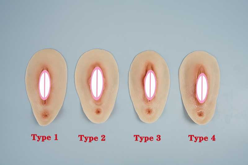 Type 1