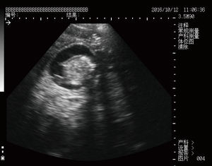 Volldigitaler tragbarer Ultraschall-Scanner für Tieren Ultraschalldiagnoseinstrumente für Tiere - Product Image 2