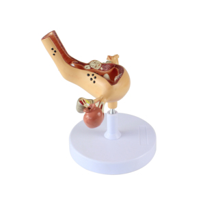 医学モデルの工場人間解剖学的病理学子宮モデル - Product Image 4
