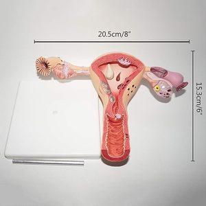 教育学習ツール婦人科子宮構造解剖学モデル人間の病理学的子宮モデル女性の繁殖組織 - Product Image 2