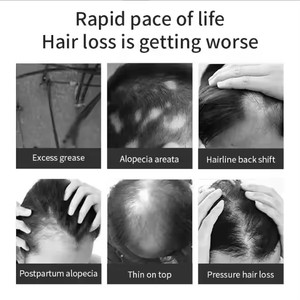 Частная Марка, 100% веганское натуральное средство для восстановления волос, органические масла для быстрого волос, масло розмарина, масло для роста волос - Product Image 2