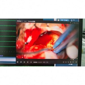 Medical IONM System <strong>Nerve</strong> Monitoring Systems for ENT/thyroid Surgery for Sale Surgical Equipment - Product Image 4