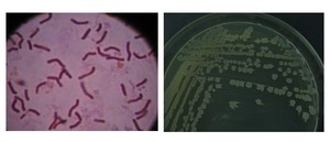 Nguồn cung lớn với giá thấp 10-200 tỷ B. Licheniformis bột công nghiệp cấp mỗi gram - Product Image 3