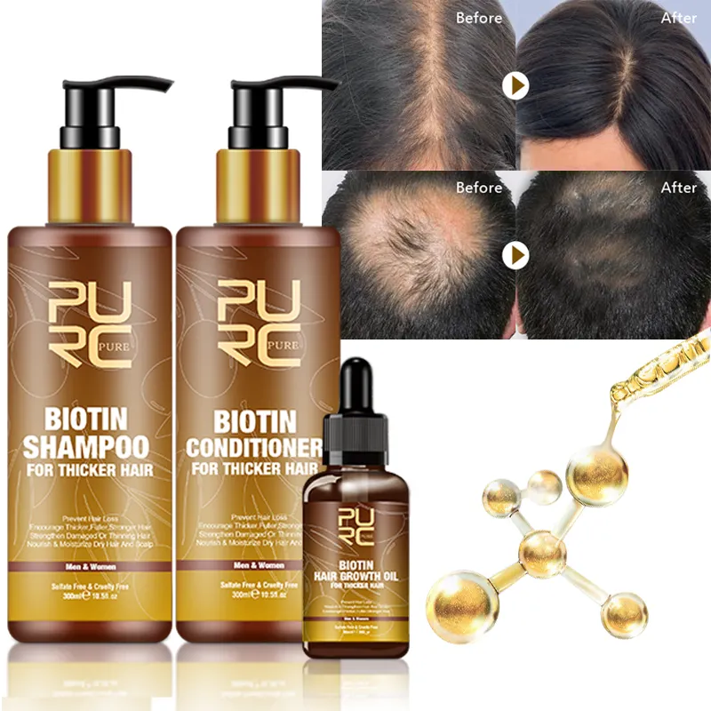 Shampoo e balsamo per la crescita dei capelli con biotina biologica a marchio privato