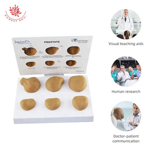 Male Prostate Anatomical Model Medical Examination <strong>Palpation</strong> Exercise Model Prostate Pathology Comparison Model - Product Image 3
