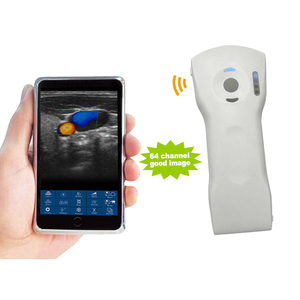 Suresult profesyonel tıbbi cihazlar: IPhone ve IPad için kablosuz USG ultrason probu - Product Image 1