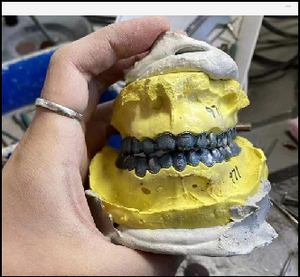 180mm Based Denture <strong>3d</strong> <strong>Printing</strong> Dmls Impresora <strong>3d</strong> Metal Powder <strong>3d</strong> Printer for Dental and Educational Sciences - Product Image 3