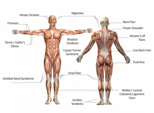 Mesin <span class=keywords><strong>Laser</strong></span> terapi intensitas tinggi kelas 4 untuk fisioterapi hewan panjang gelombang 810nm 980nm 1064nm penggunaan klinik - Product Image 5