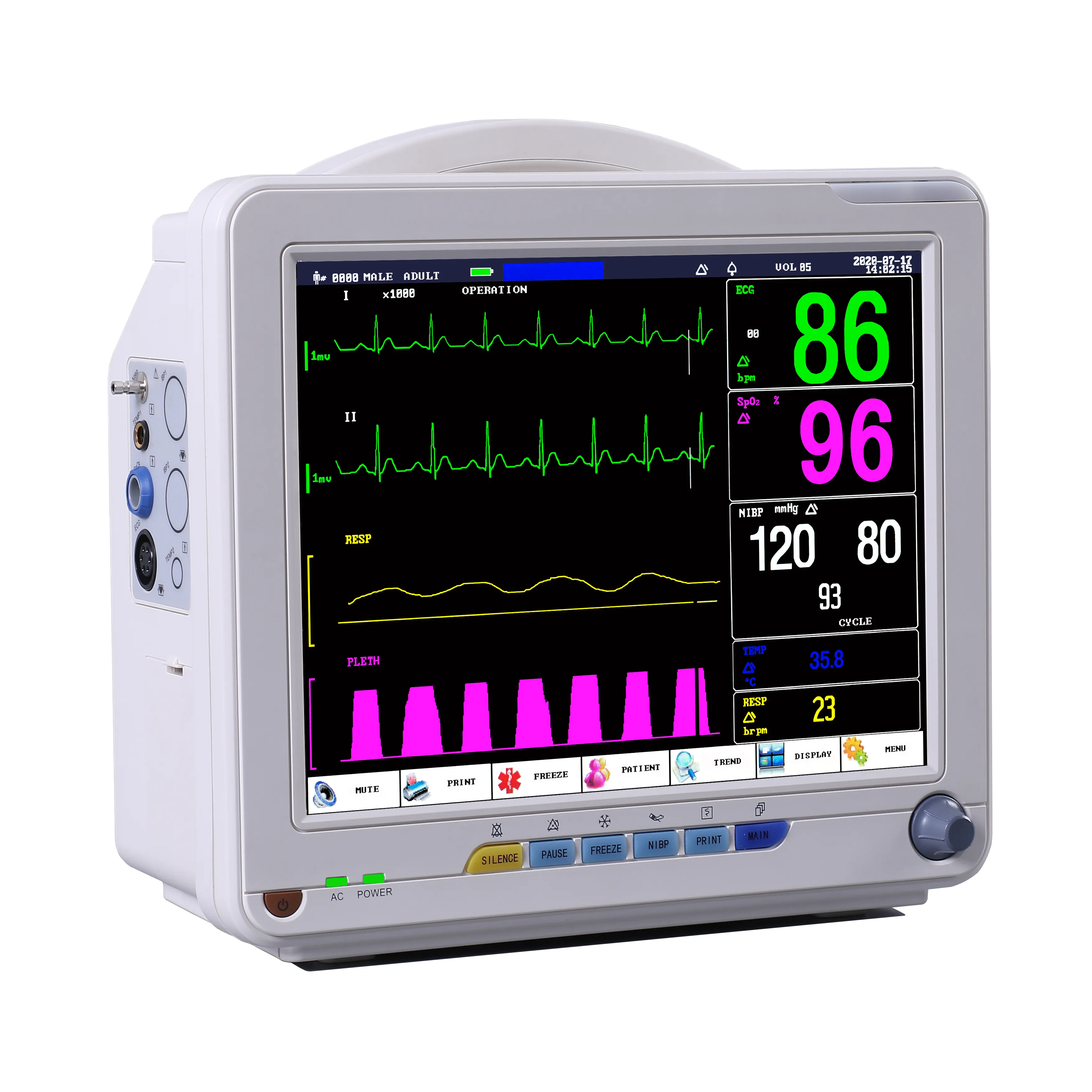 Monitor portatile da 12.1 pollici per animali veterinari ICU multiparametrico per segni vitali ECG ETCO2 Pet Monitor