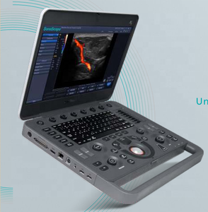 Sonosape X5 Blue-Tooth Siêu Âm 3d Doppler Siêu Âm Giá Máy/Máy Siêu Âm 3d 4d - Product Image 2