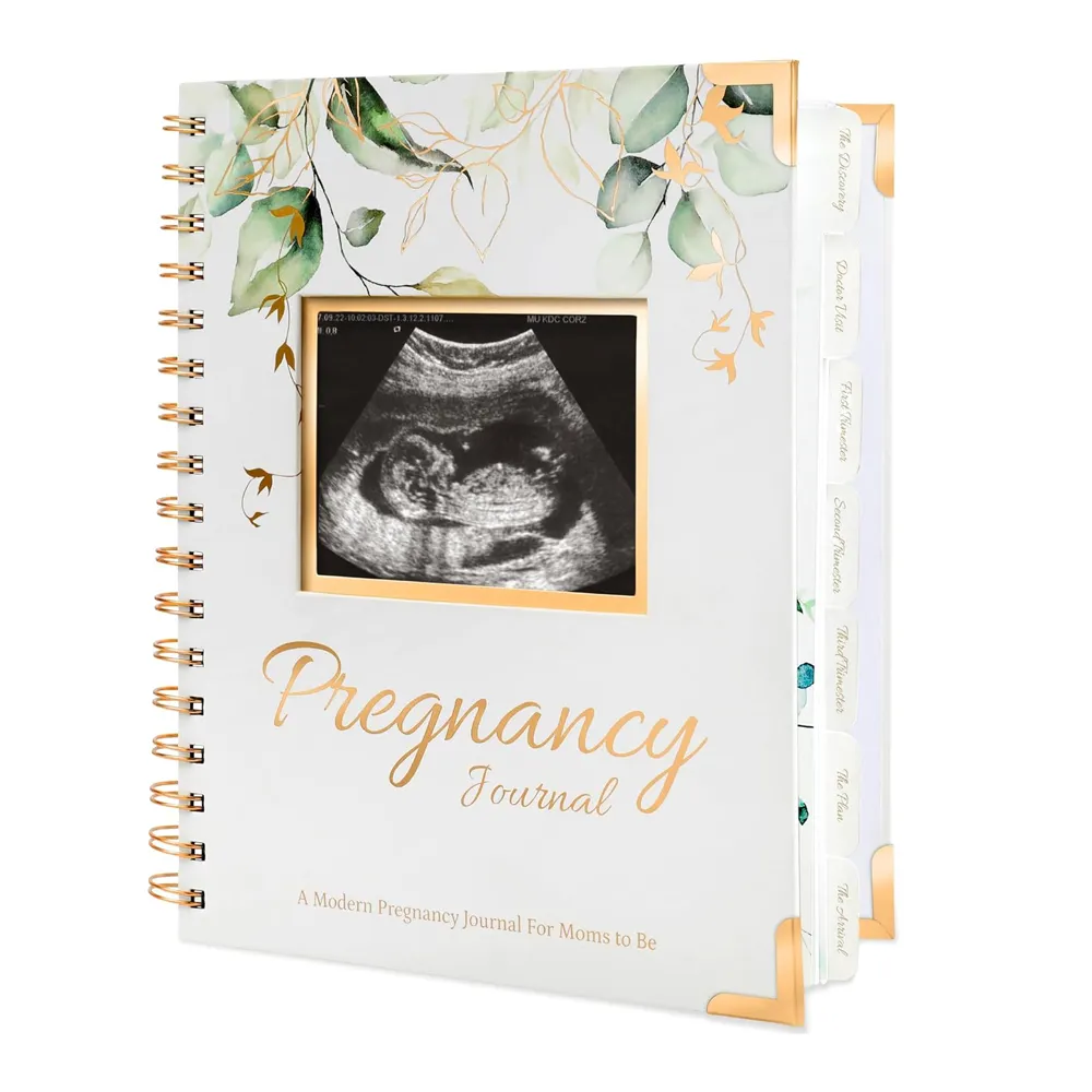 कस्टम बेबी मेमोरी बुक चिल्ड्रेन बुक्स स्पाइरल प्रिंटिंग हार्डकवर अल्ट्रासाउंड बेबी गर्भावस्था प्लानर कॉर्नर के साथ