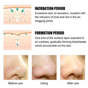 100% Tự Nhiên Hữu Cơ Than Tre Mặt Xà Phòng Rắn Thanh Sâu Làm Sạch Tẩy Tế Bào Chết Với Màu Đen Bùn Bán Buôn - Product Image 5