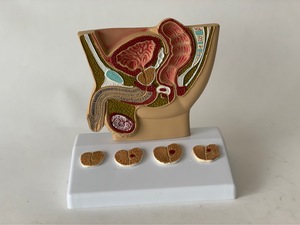 Adult Male Abdominal Bladder Prostate Anatomy Prostate Health Pathological Comparison Doctor-patient <strong>Explanation</strong> Model - Product Image 2
