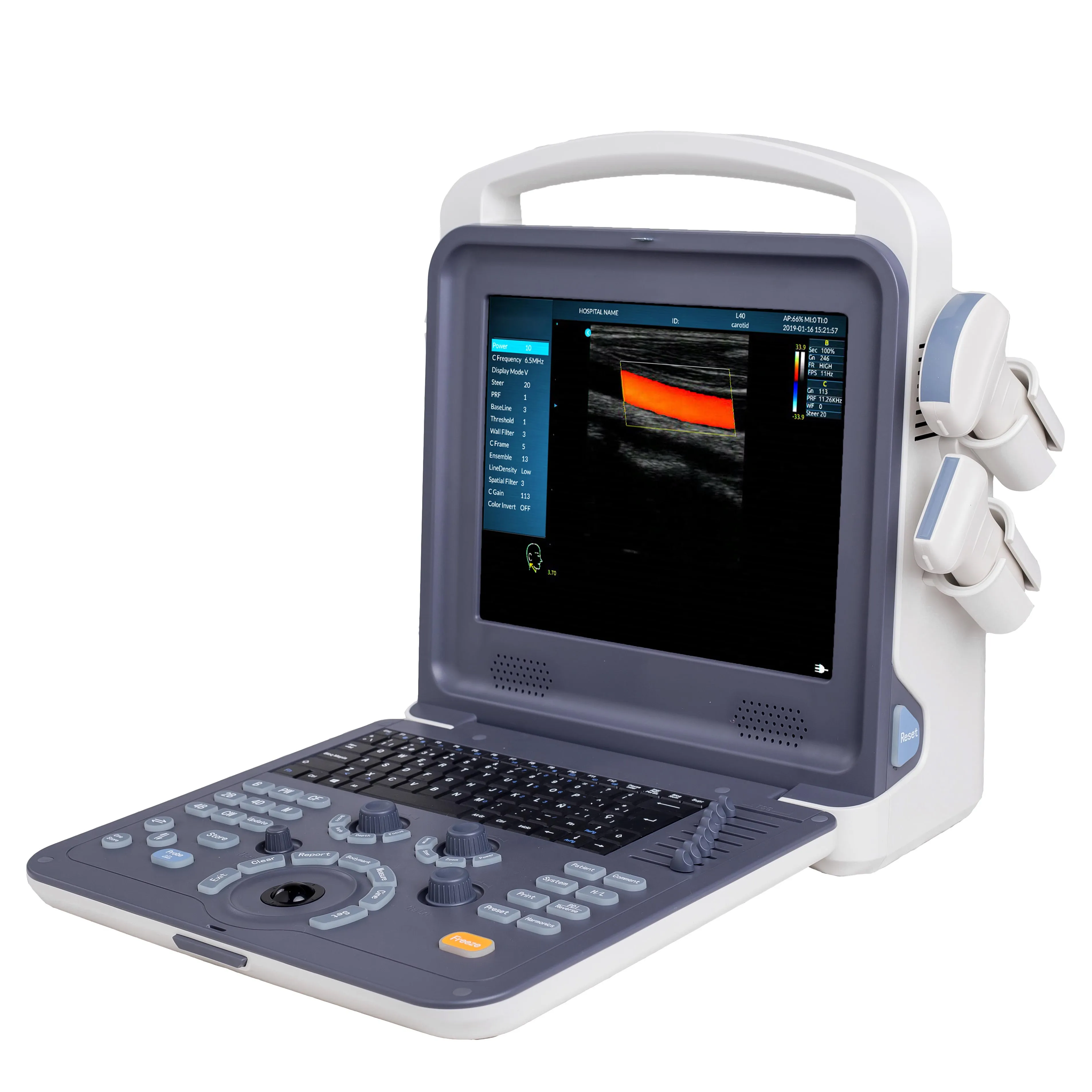 Medizinische Led klinische Anwendung Echografie tragbarer Farbdoppler B/w Ultraschallscanner Ultraschallgerät